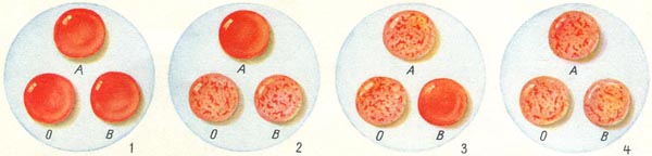определение групп крови